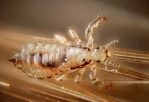 Fejtetű (Pediculus humanus capitis) fejtetű