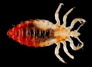 Ruhatetű (Pediculus humanus humanus) ruhatetű