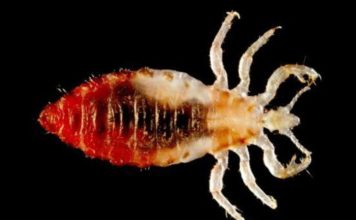 Ruhatetű (Pediculus humanus humanus) ruhatetű