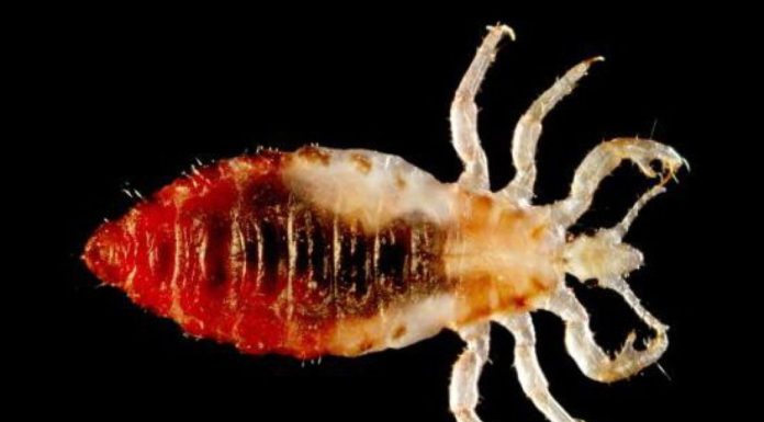 Ruhatetű (Pediculus humanus humanus) ruhatetű