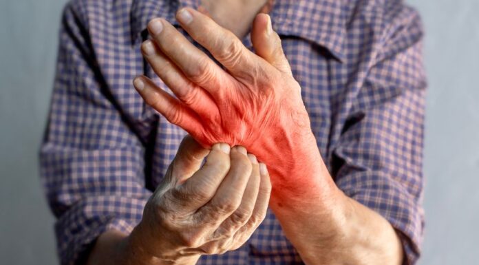 Az emberi rühesség felismerése rühesség